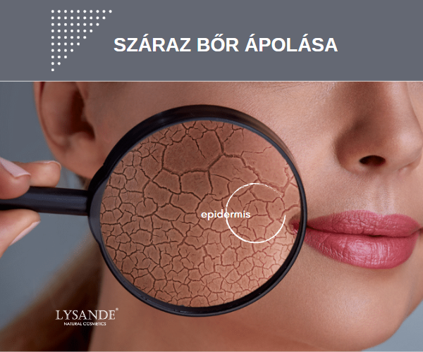 A száraz bőr - a száraz bőr okai, tünetei, ápolása