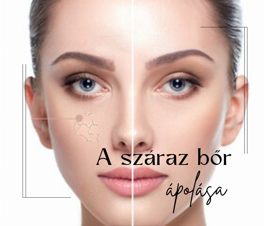 A SZÁRAZ BŐR - A SZÁRAZ BŐR OKAI, TÜNETEI, ÁPOLÁSA
